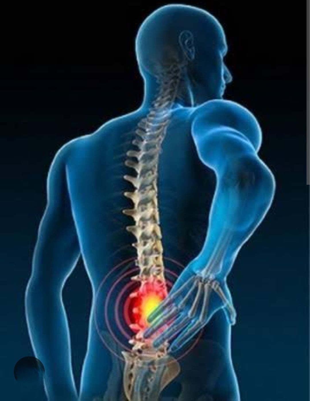 Back pain management