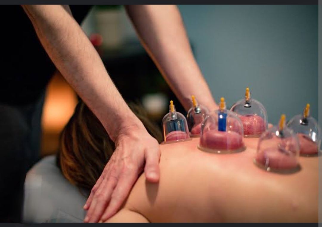 Cupping Tharapy